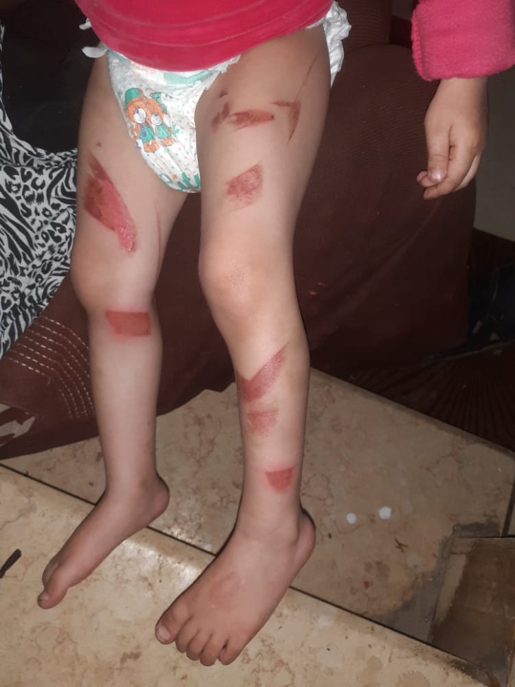 الطفلة فريدة رمضان عشري