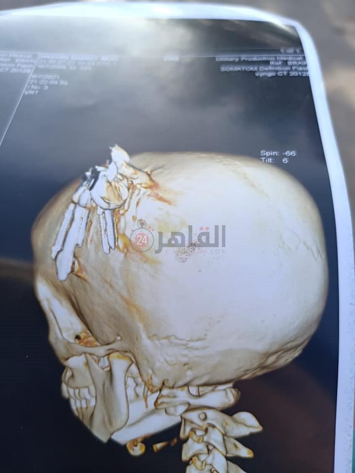 200014534_10157688325491601_9160027257898312684_n