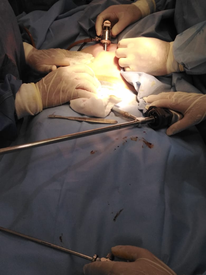 منظار طبي لسيدة ألمانية في  مستشفى منيا القمح