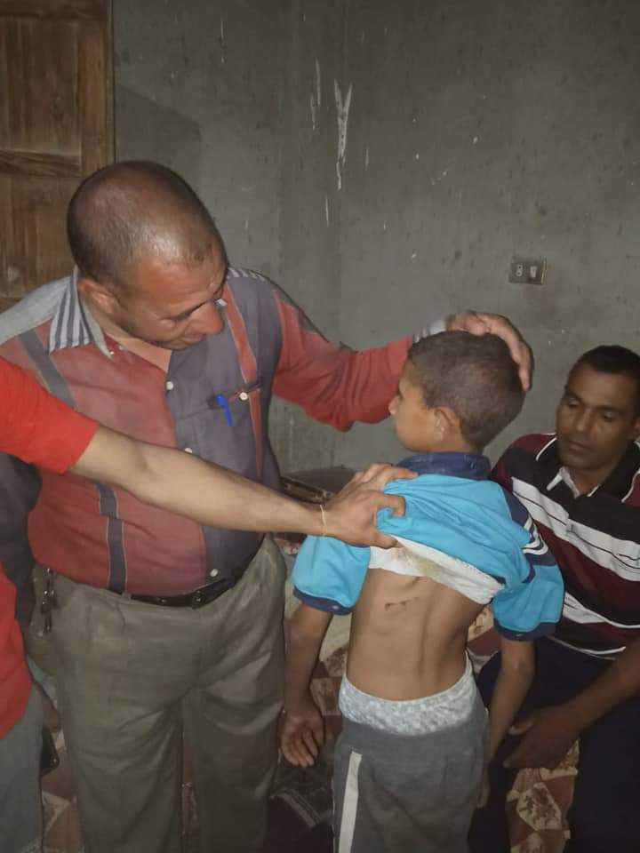 كلب مسعور يهاجم أطفال في الفيوم