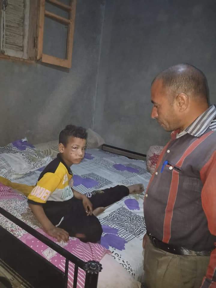 الأطفال المصابين بعقر كلب مسعور في الفيوم