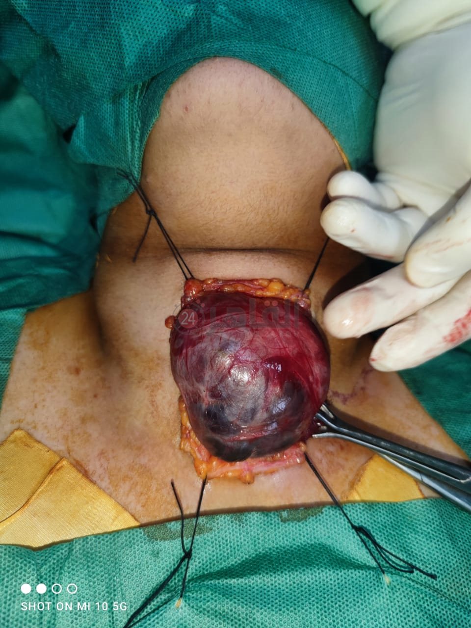 a2498857-9557-4f1d-b248-f4bf5bb8adb7