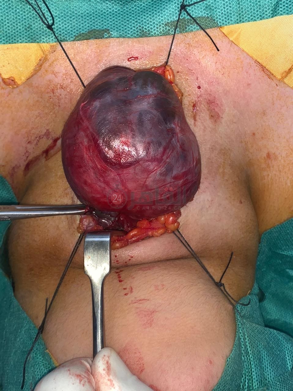 b3ab83f9-2ecc-4fa1-88a3-fce55f846004