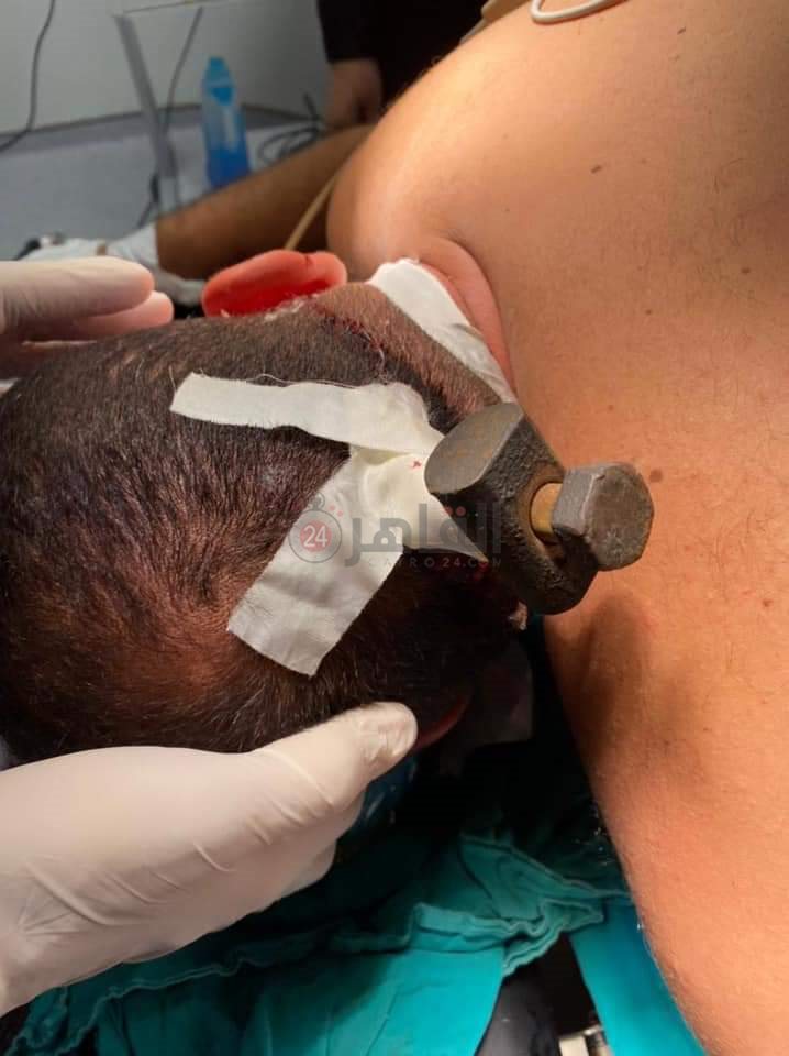 FB_IMG_1626784648902