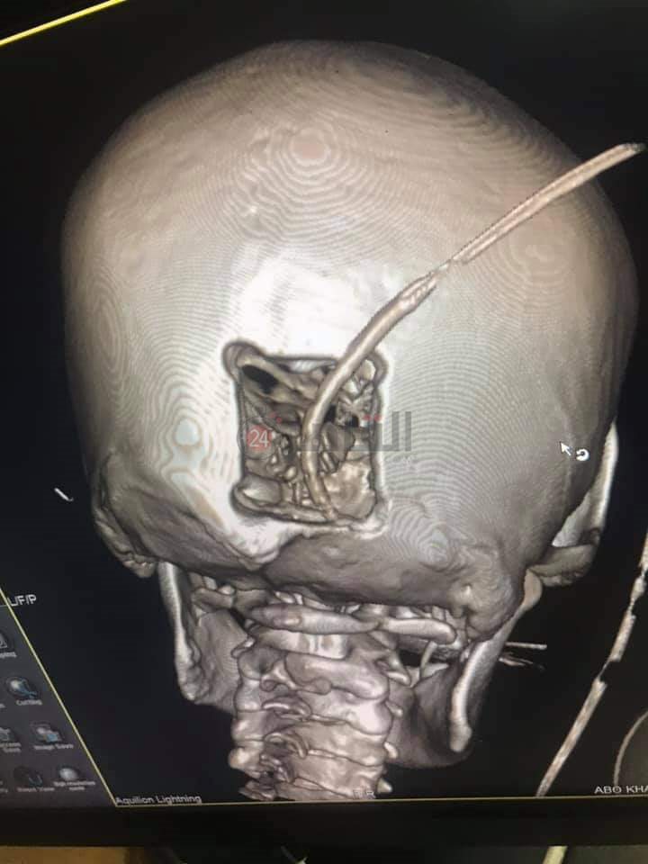 FB_IMG_1626784640344