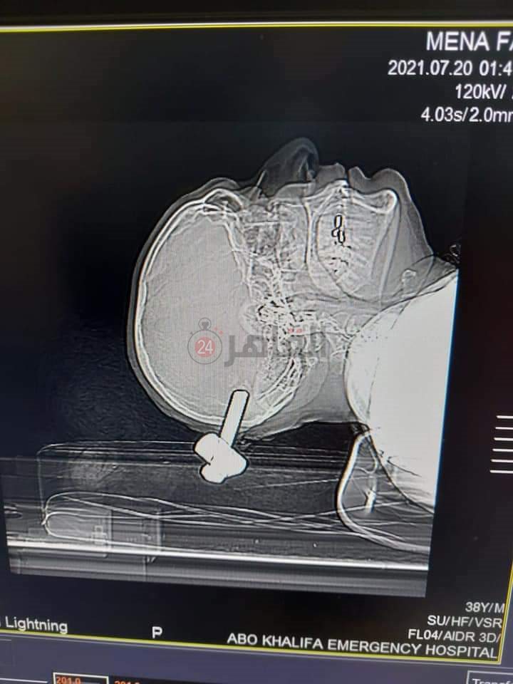 FB_IMG_1626784636473