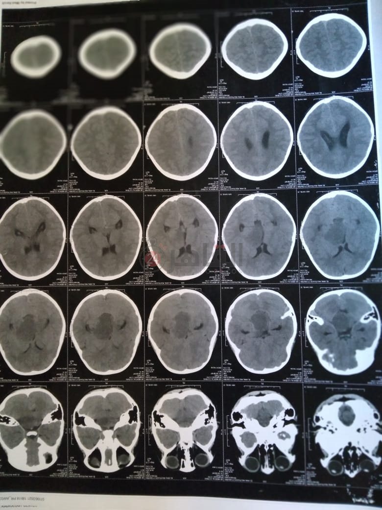 22379ef9-2c9d-426a-9f20-212360508183