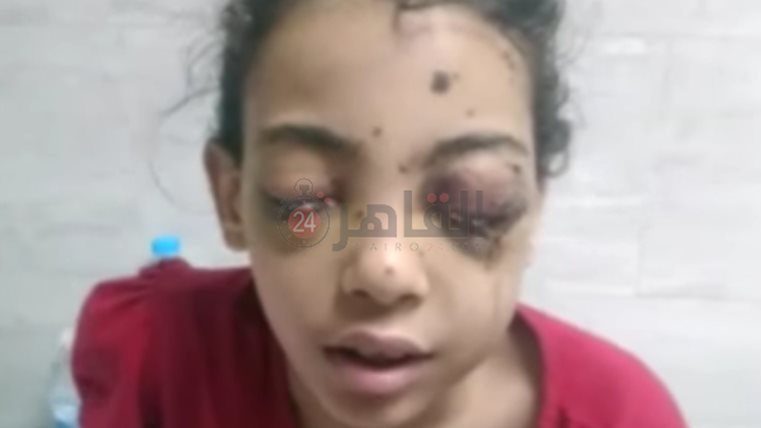 احد الأطفال المصابين 