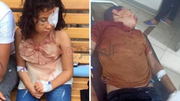 احد الأطفال المصابين 