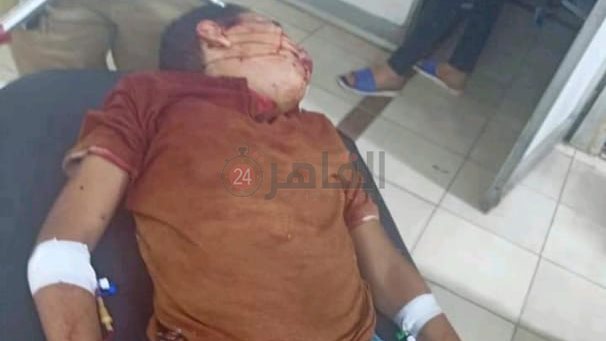 احد الأطفال المصابين 