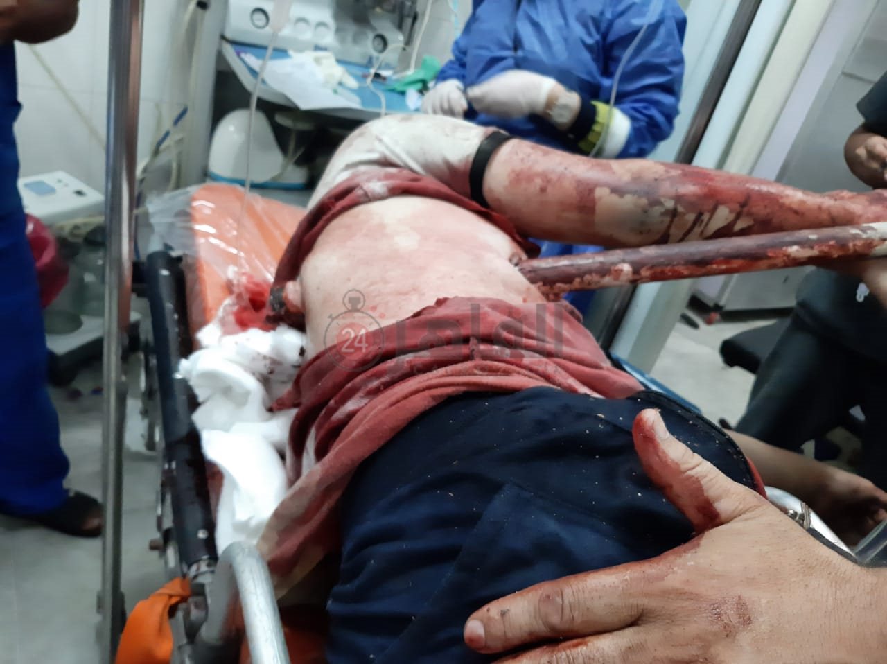 الماسورة في صدر الشاب 01