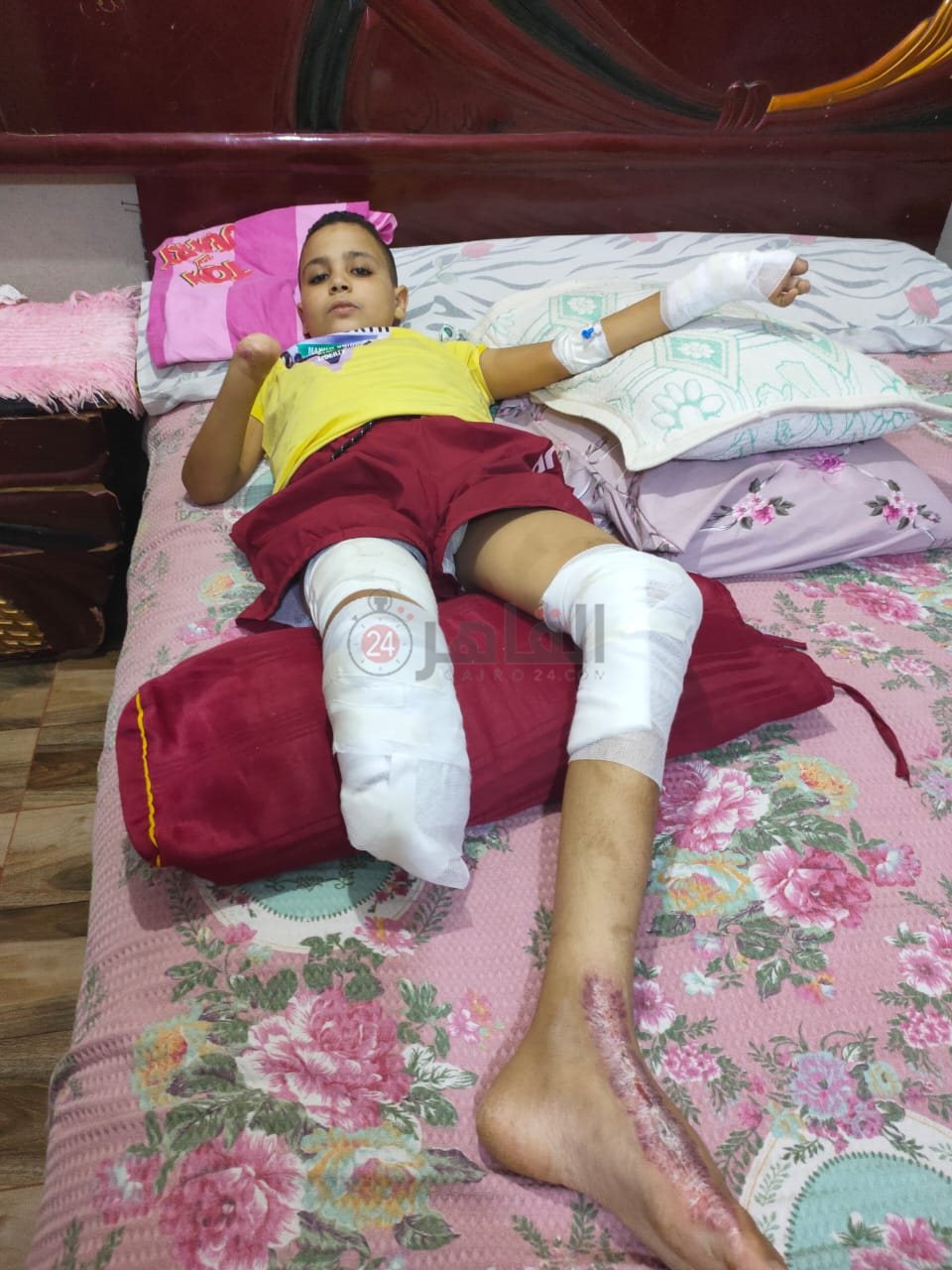 الطفل المجني عليه