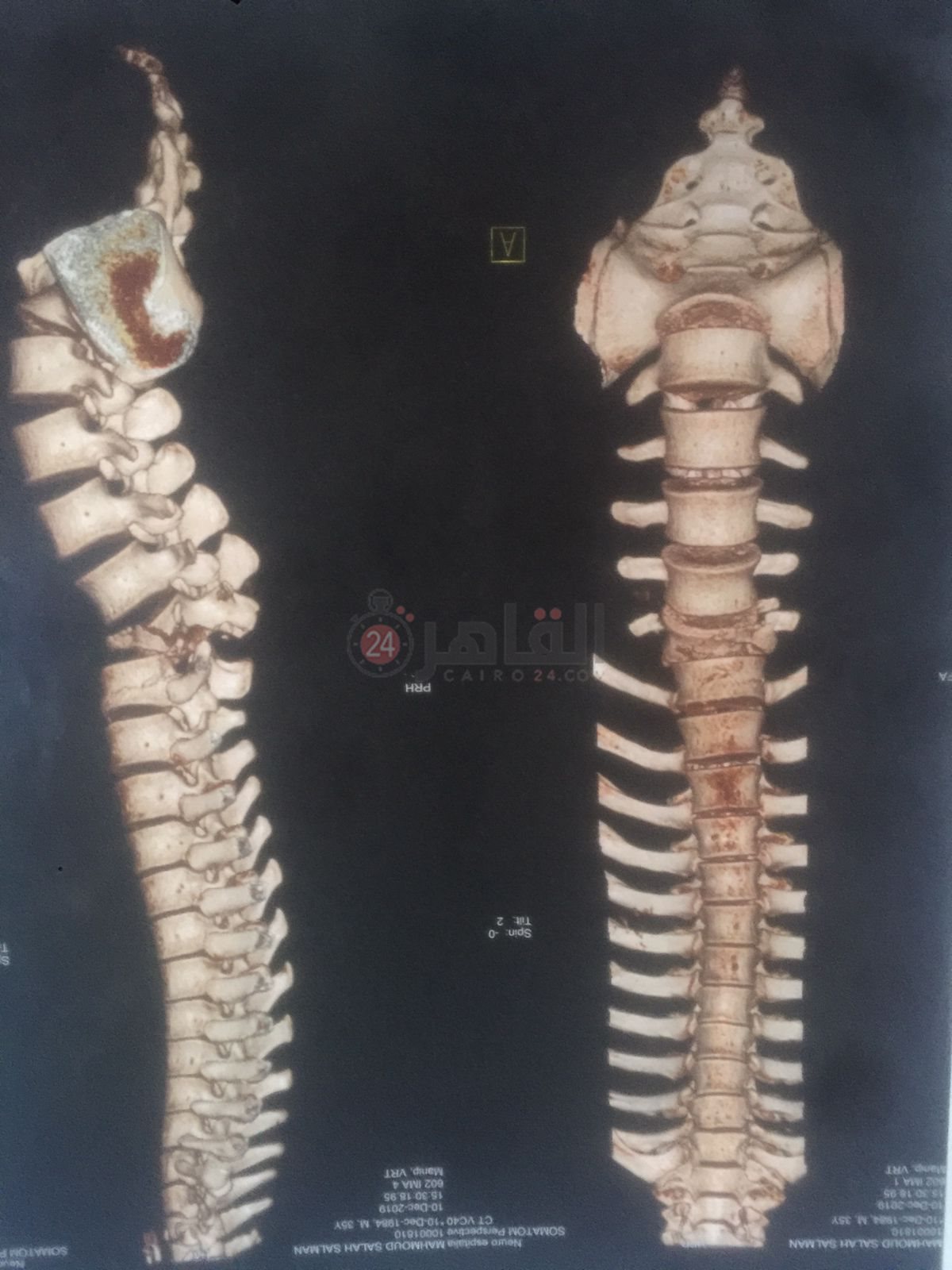 67167413-f0ef-40fa-9f3d-a7894fbef9c9