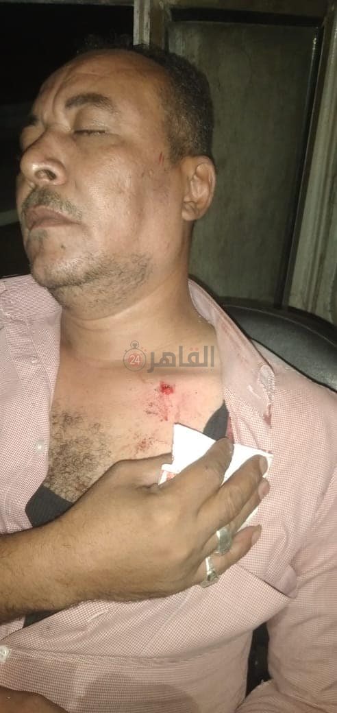  اصابة محمود محمد هميمى قائد القطار