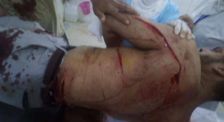 الاعتداء على شاب بالفيوم