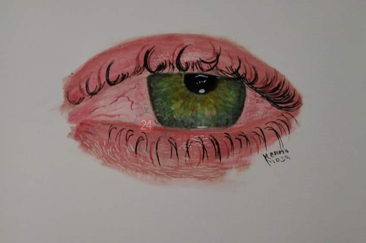 عين بألوان مختلفة