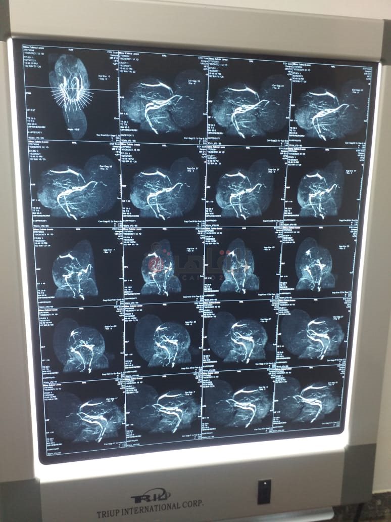 30b04fa0-be64-4964-991e-8bbcfac0e1d9