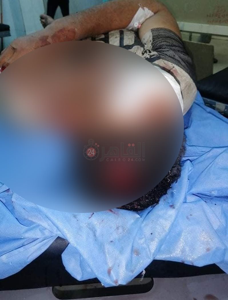 b3e29410-552e-44a1-a75d-8341b9bd6139