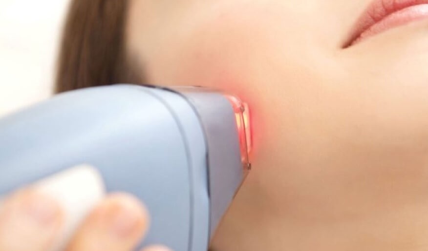 خطورة إزالة الشعر بالليزر للنساء