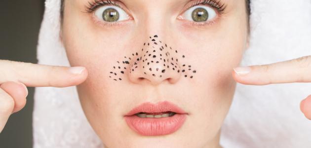 تنظيف الرؤوس السوداء 