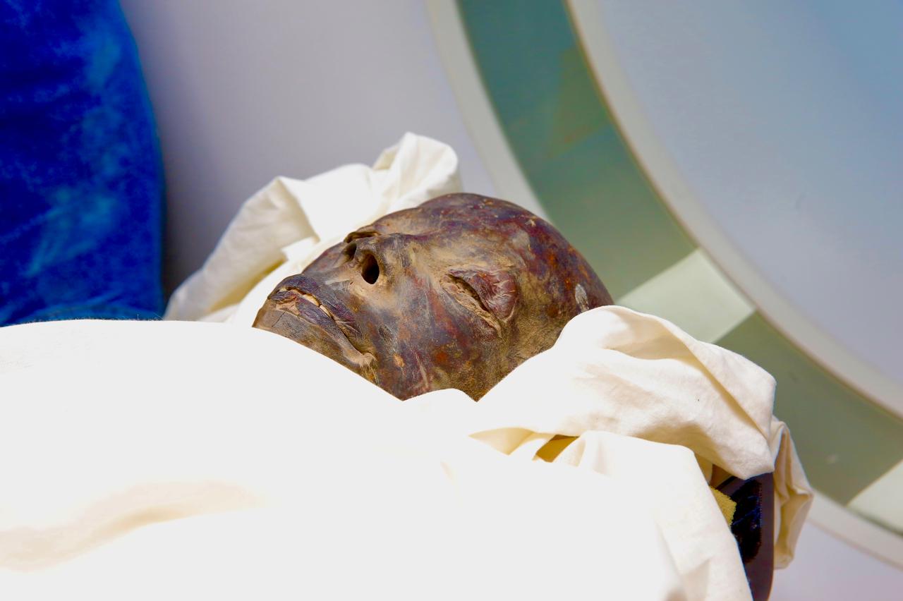 مومياء فرعونية بمستشفى أورمان الأقصر