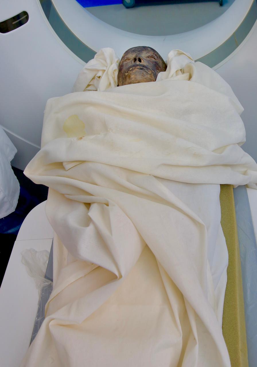 مومياء فرعونية بمستشفى أورمان الأقصر