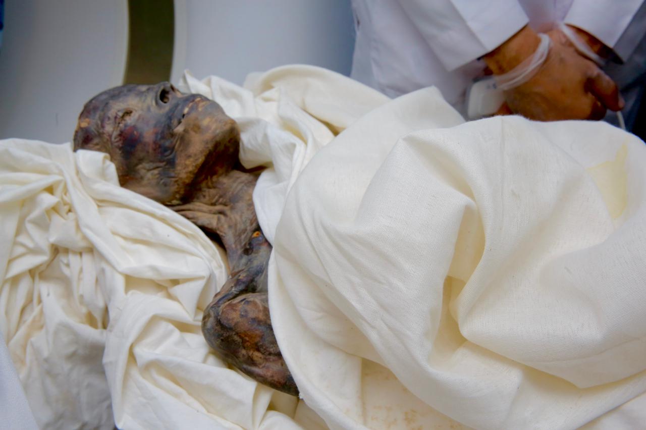 مومياء فرعونية بمستشفى أورمان الأقصر