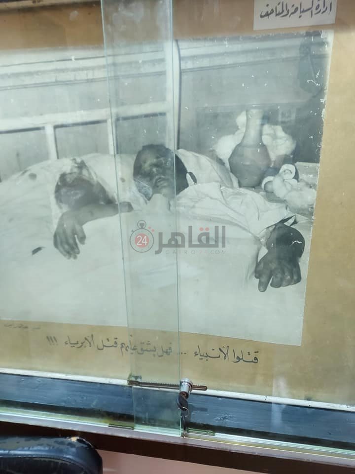 صورة لأحد الضحايا المصابين وقت المجزرة