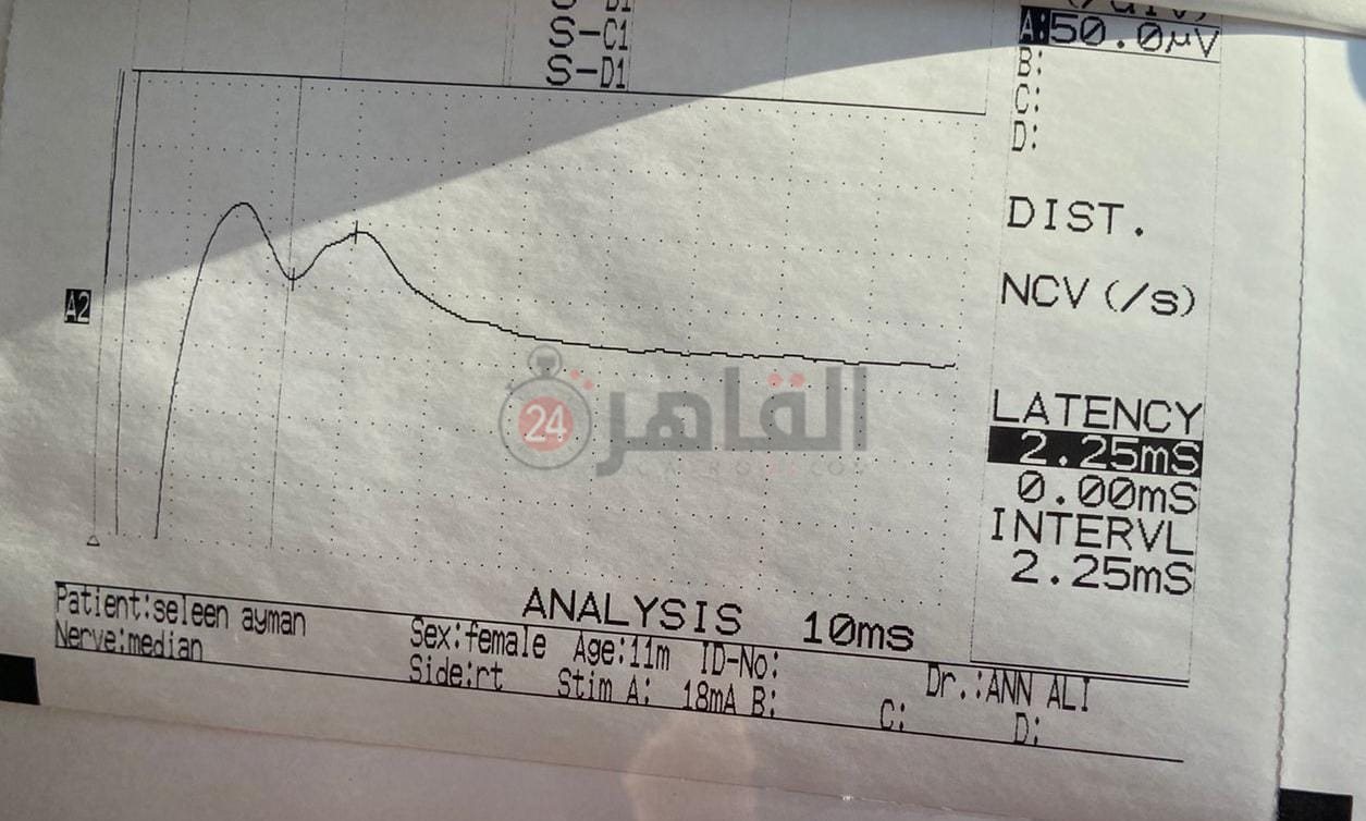 87174684-ec9a-404b-8c93-8ac4e0a99022