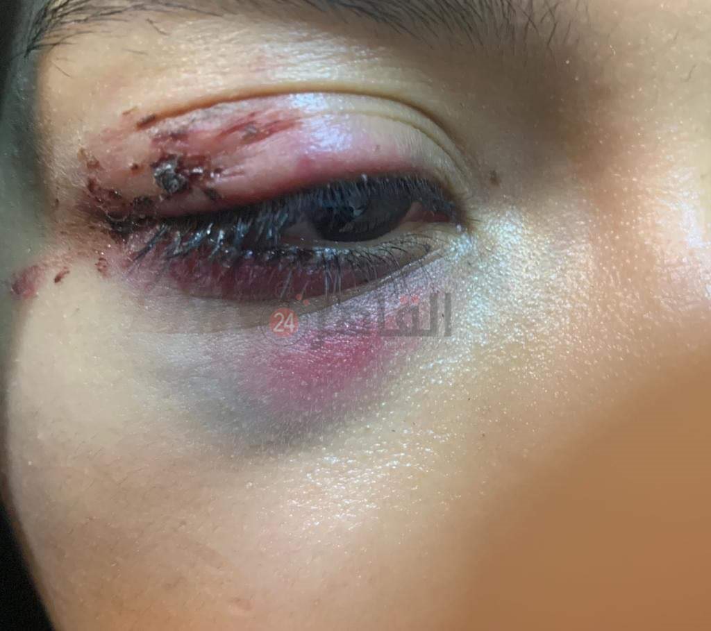 المجني عليها 