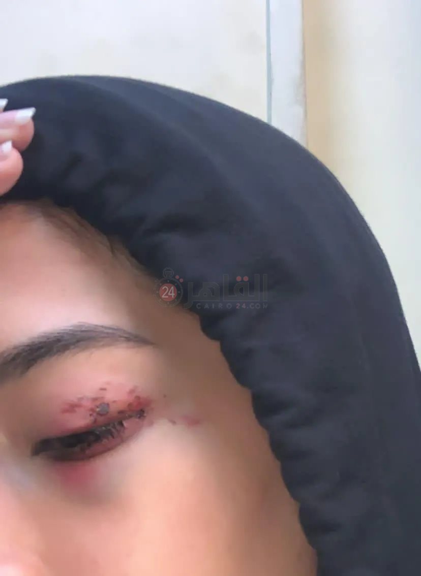 المجني عليها 