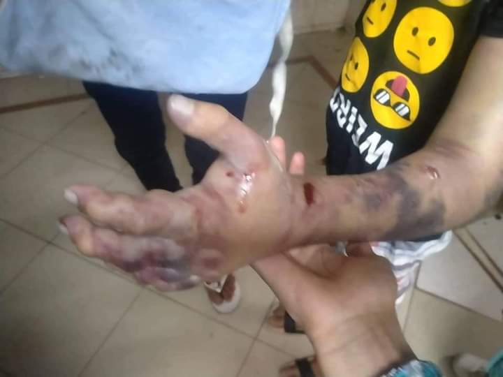 ذراع الطفل محمد 