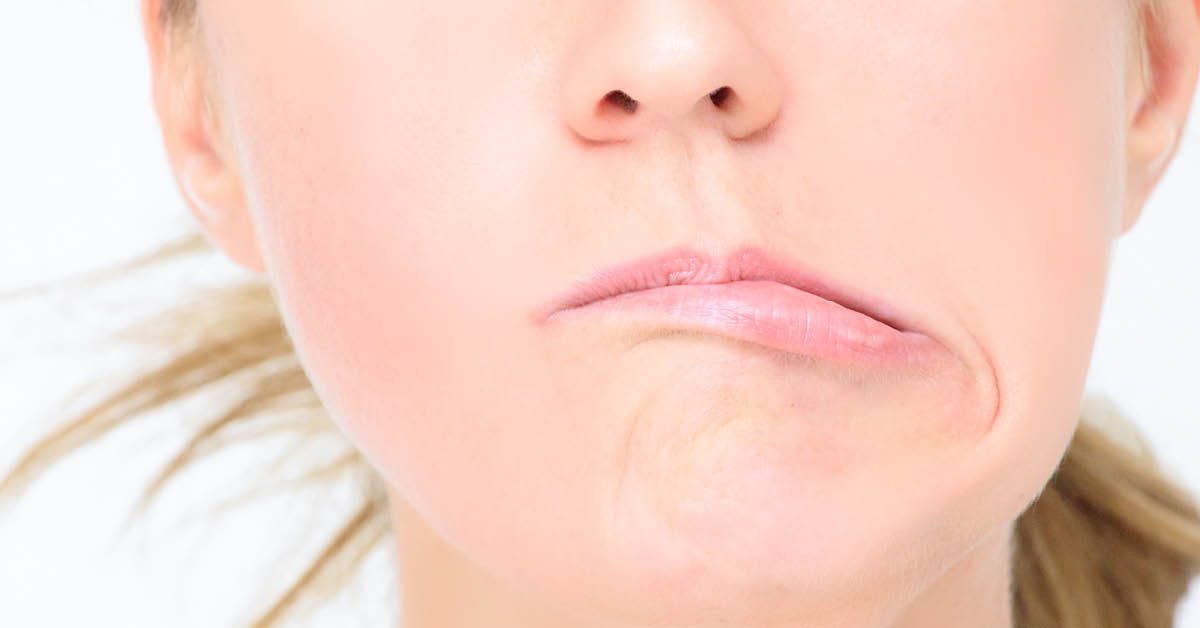 أسباب العصب السابع