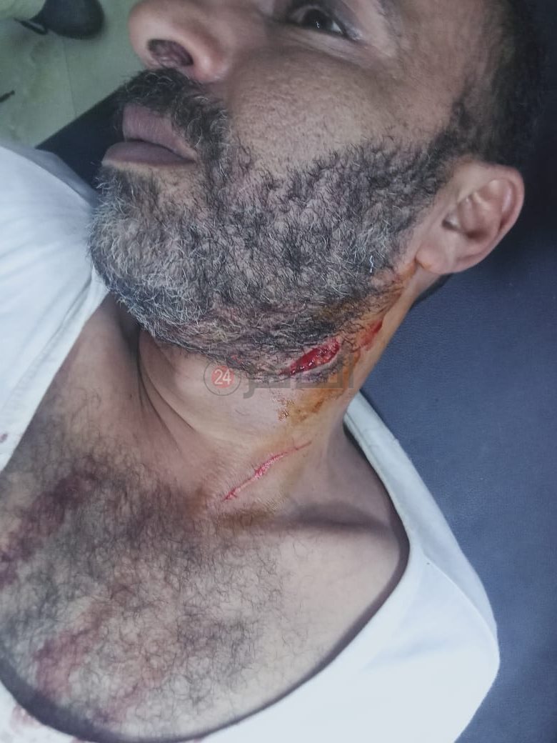 آثار الذبح على رقبة المجني عليه الأول