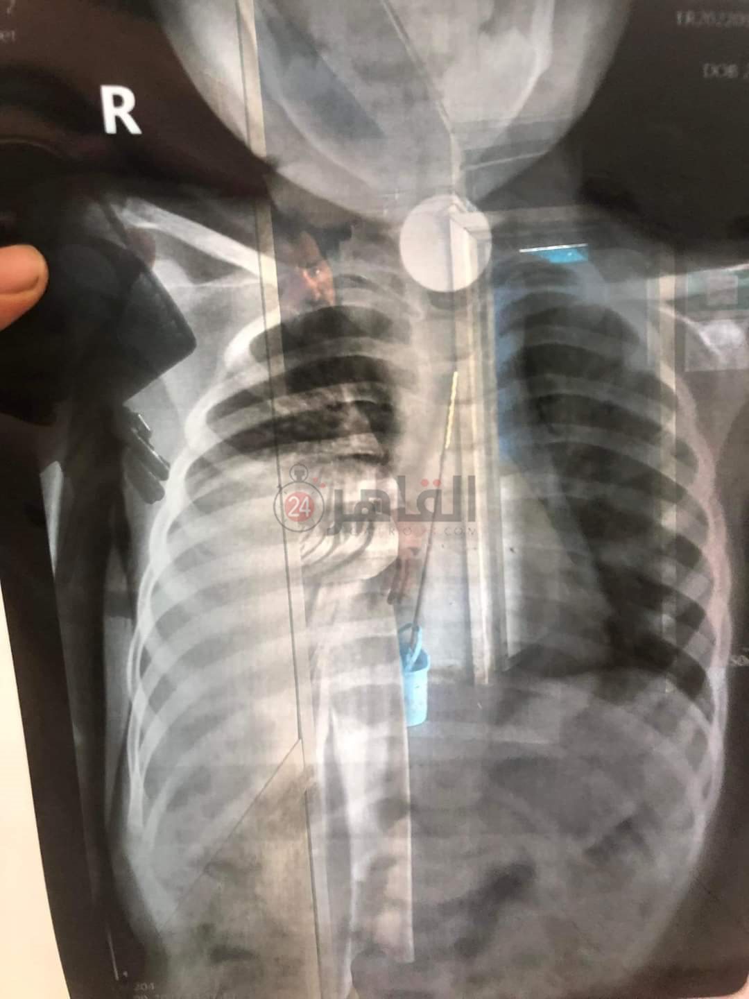 FB_IMG_1664090247579