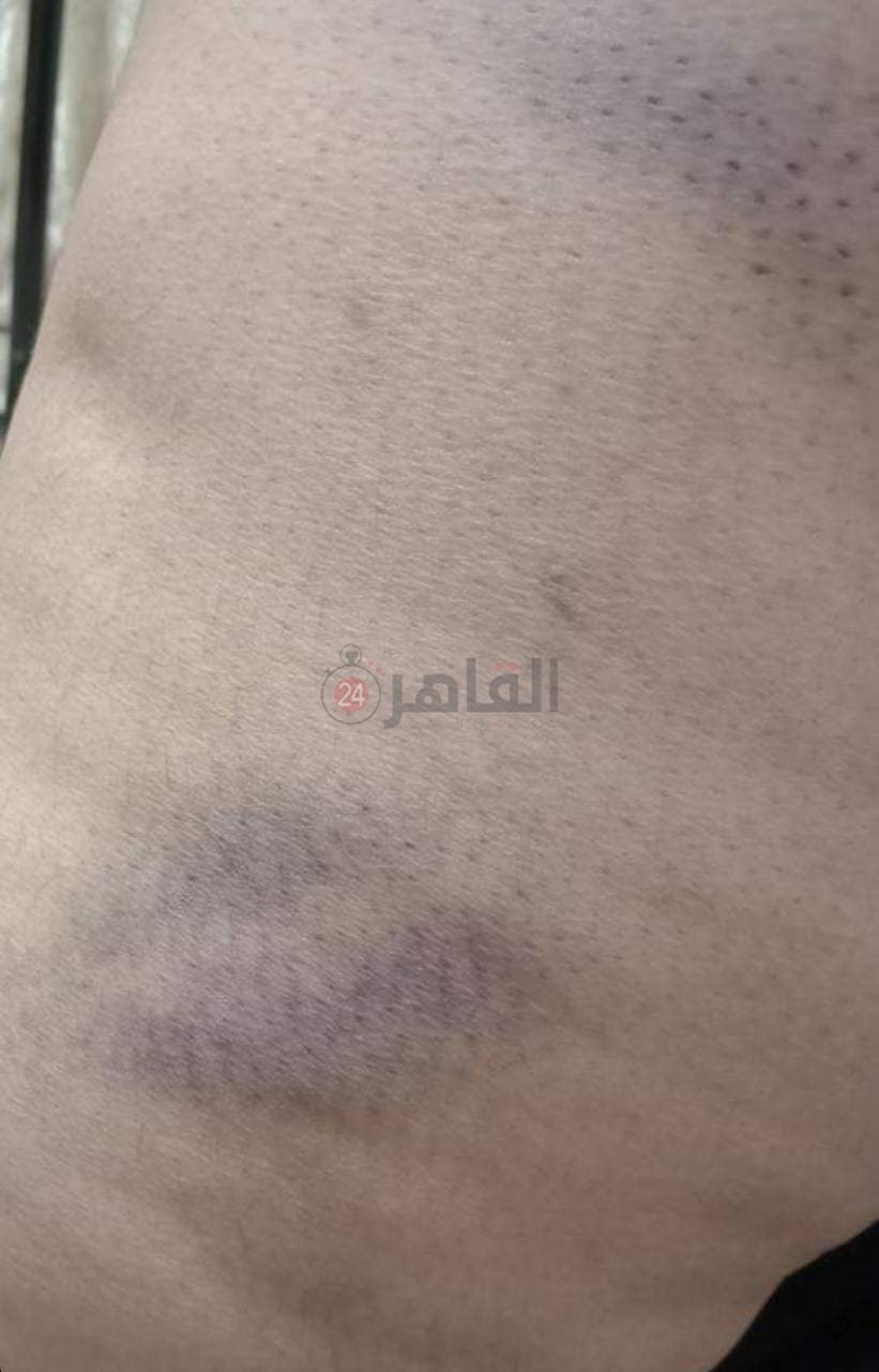 8af46377-7827-444e-9c65-d06f16cc53c9