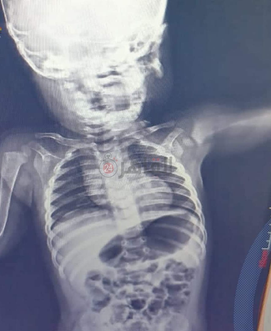 IMG_٢٠٢٢١٠٢٢_١٠٥٧٥٣