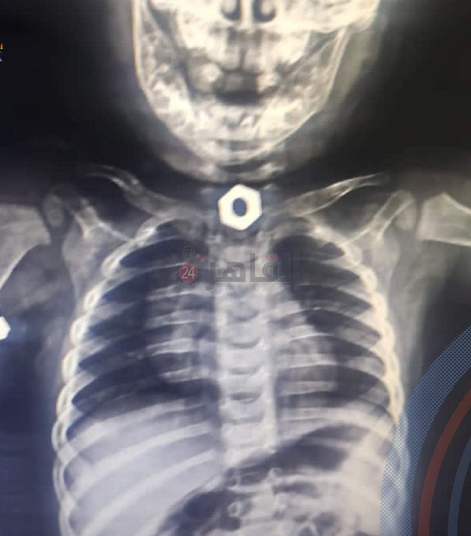 IMG_٢٠٢٢١٠٢٢_١٠٤٤١٣