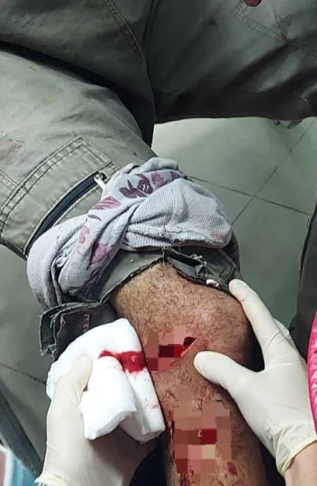 إصابة الشاب