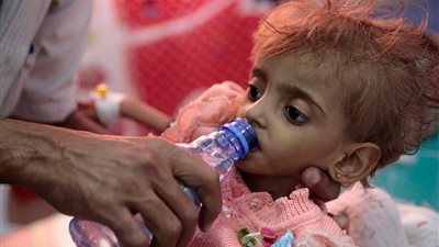 “فيسبوك” يحظر مؤقتًا نشر صور أطفال اليمن ويعاود نشرها