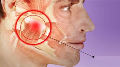 احترس “الطقطقة والم الفك والتورم” أشهر أعراض الالتهاب الصدغي