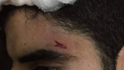طبيب “طوارئ طنطا” يروي لـ “القاهرة 24” تفاصيل الإعتداء عليه (صور)