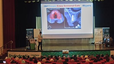 على مدار ثلاث أيام.. الجامعة البريطانية تنظم مؤتمر علاج جذور الأسنان