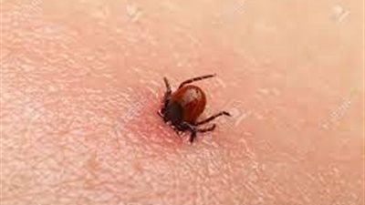 بريطانيا تؤكد إصابة 3 حالات بـ التهاب الدماغ بسبب الجراد