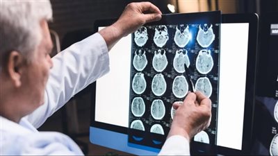 خوفًا من انتشاره.. المعهد الأمريكي للشيخوخة يخصص 300 مليون دولار للأبحاث المتعلقة بالخرف