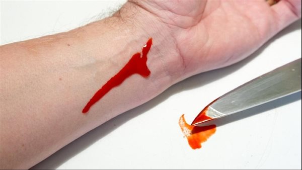 محاولة إنهاء حياة