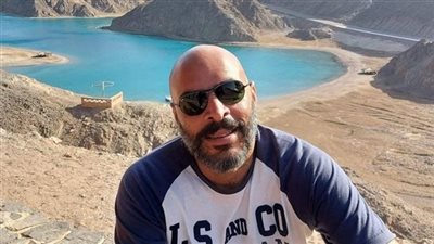 بعد وفاة مدير بنك.. طبيب بيطري يكشف خطورة عضة الكلب