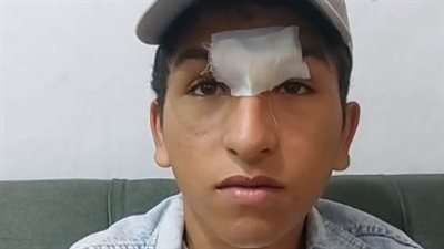 4 شباب يعتدون على آخر داخل محل بلايستيشن بالمحلة.. والضحية: ضربوني عشان دافعت عن صاحبي| بث مباشر