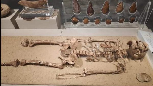 وجه هيكل نزلة خاطر