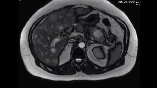 فحص الحالة الطبية